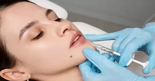 Lip Filler Uses Providers Photos Cost Belorens