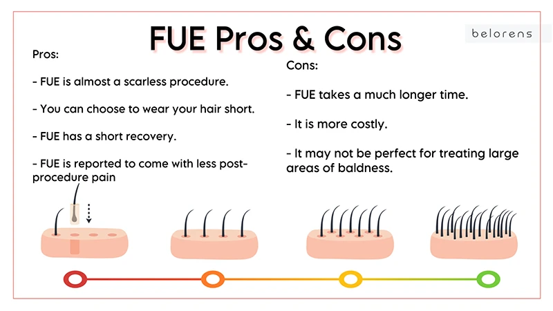 Pros-and-Cons-of-FUE