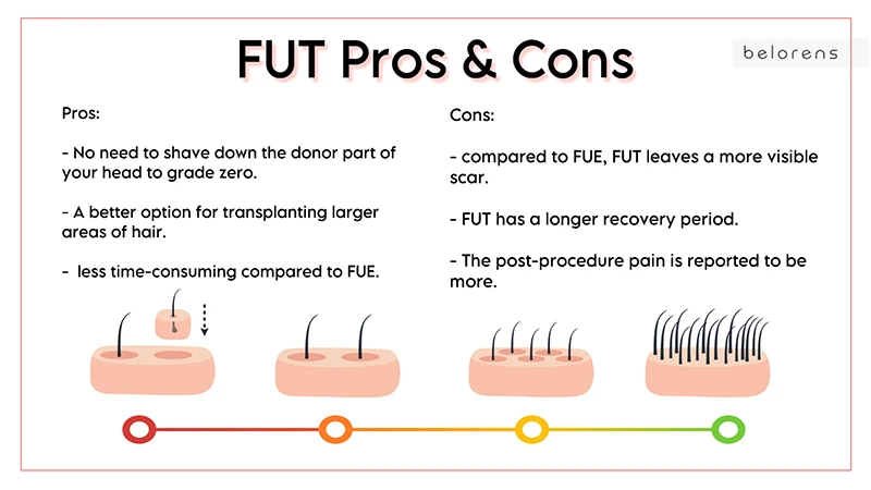 Pros-and-Cons-of-FUT
