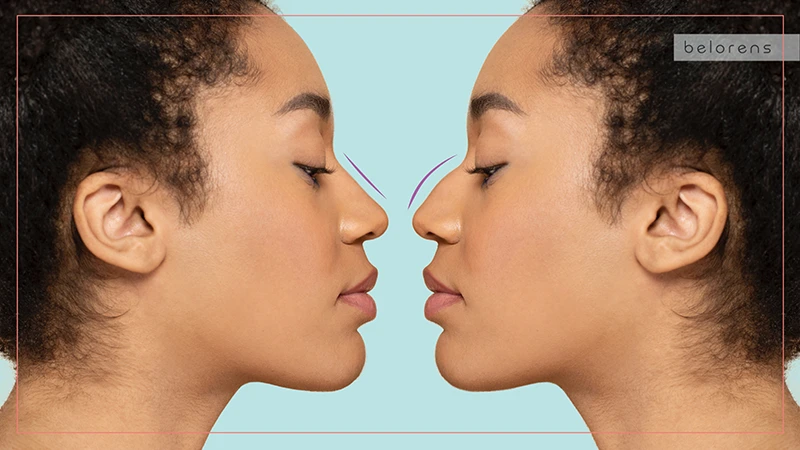 Imaging before the operation