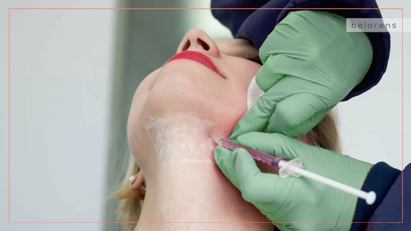 Dermal Fillers