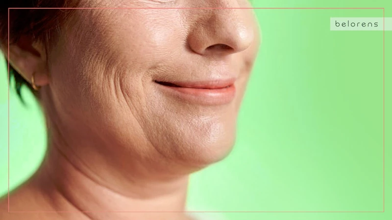 Jowls-are-Commonly-Associated-With-Aging
