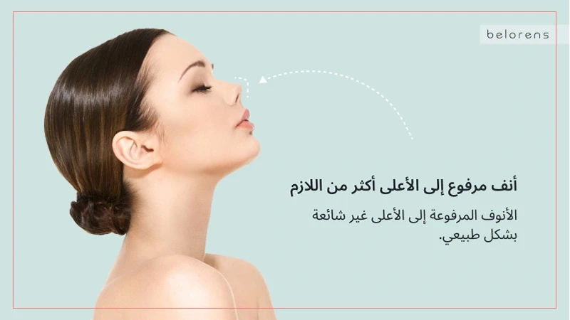 upturned nose - nose job detection 