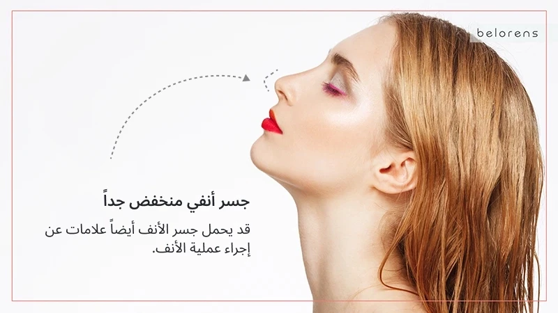 The bridge of my nose is very low