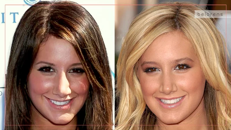 Ashley Tisdale Before and After Nose Reshaping
