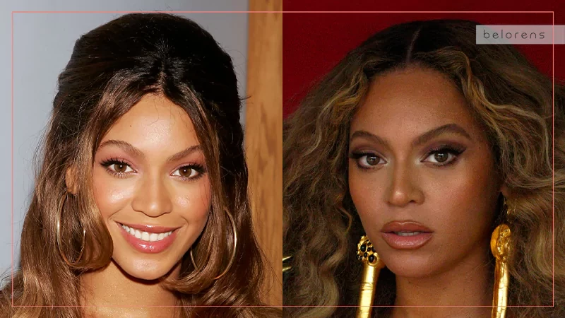 Beyonce Before and After Nose Surgery