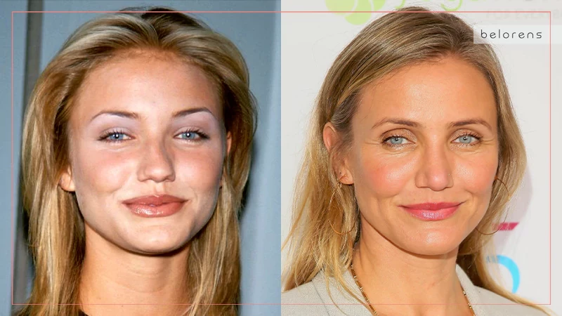 Cameron Diaz Before and After Nose job