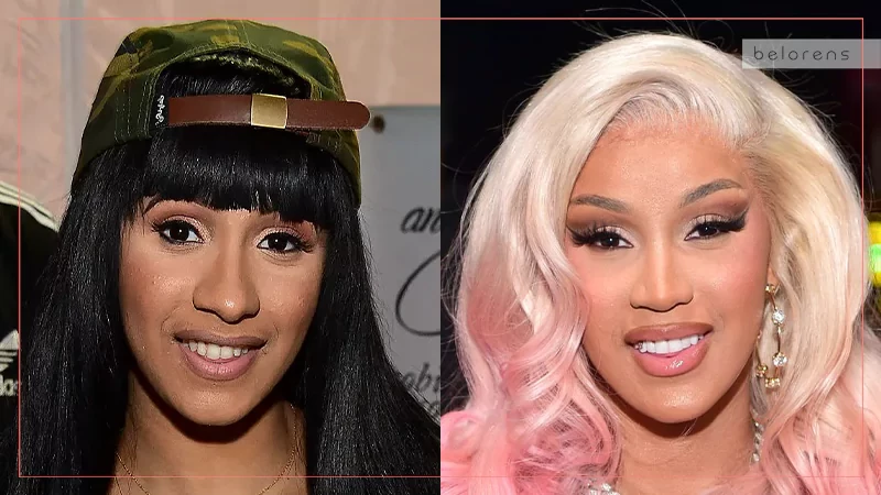 Cardi B Before and After Nose job