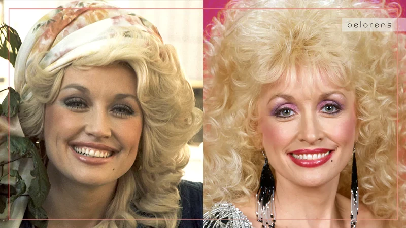 Dolly Parton Before and After Nose job