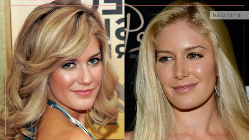 Heidi Montag Before and After Nose job