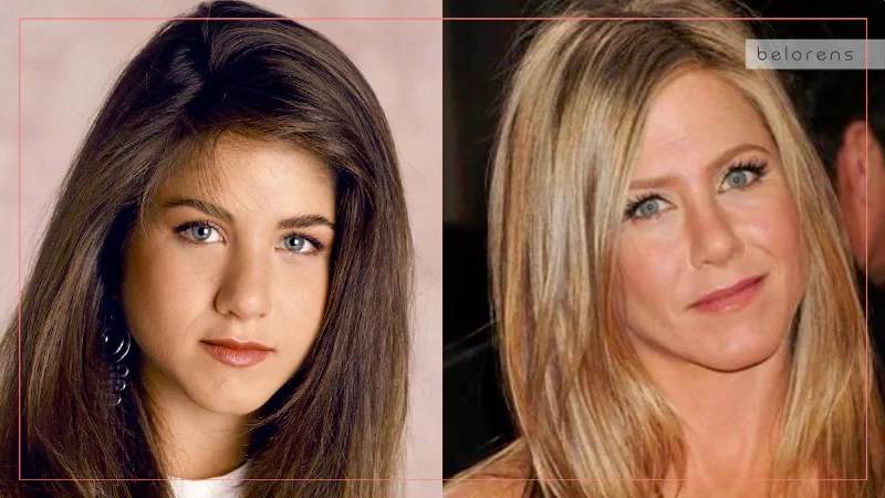 Jennifer Aniston Before and After Nose job