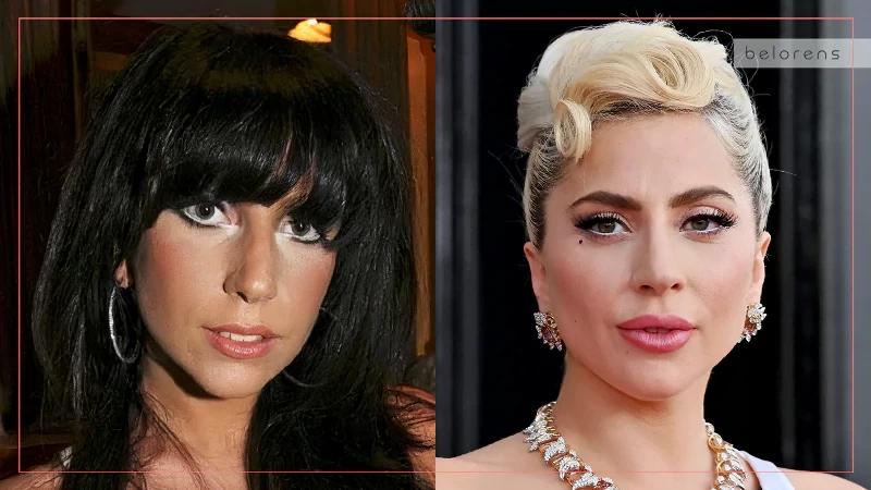 Lady Gaga Before and After Nose job