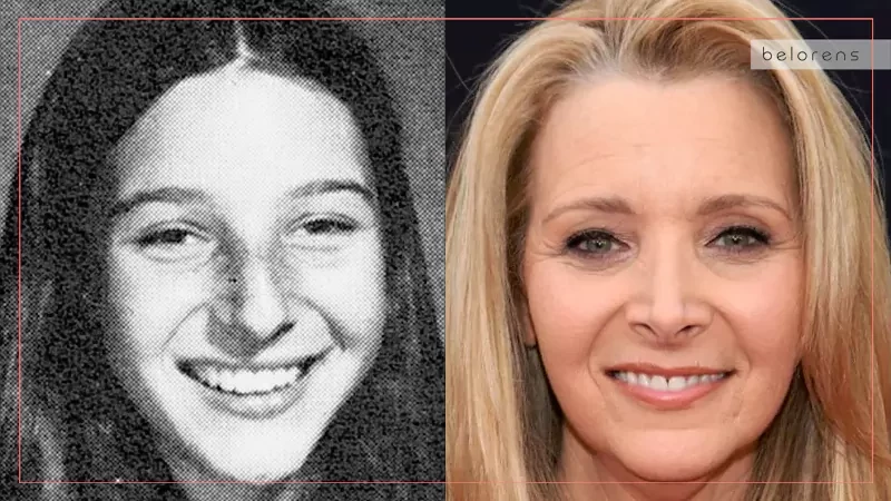 Lisa Kudrow Before and After Nose Reshaping