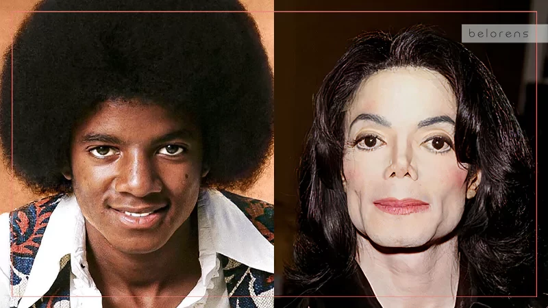 Michael Jackson Before and After Rhinoplasty