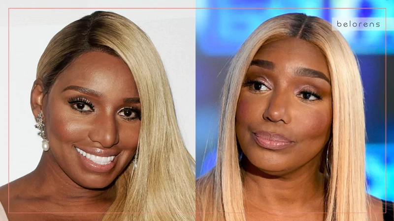 NeNe Leakes Before and After Nose Reshaping