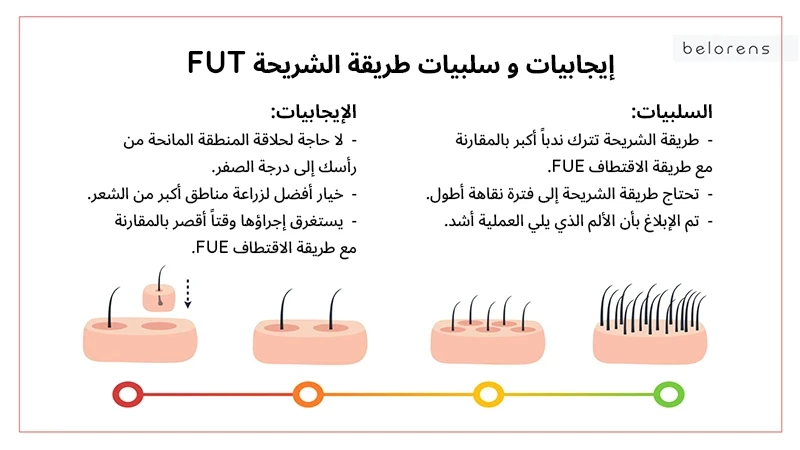 Pros and cons of the FUT bracket method