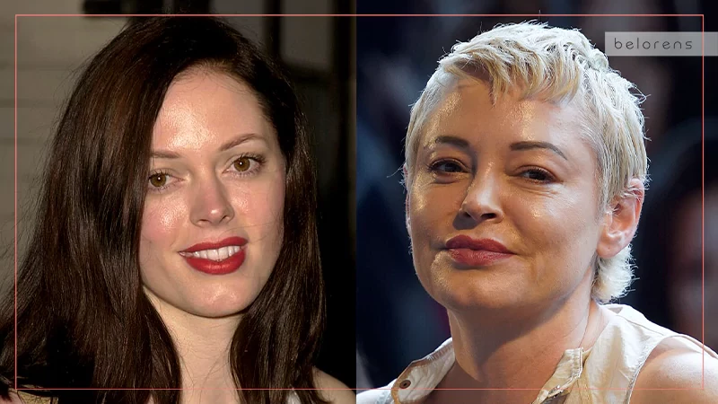 Rose McGowan Before and After Nose job