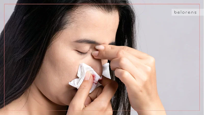 How long should nosebleeds after nose surgery last