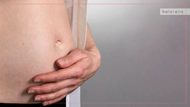 how-to-make-abdominoplasty-scars-less-visible