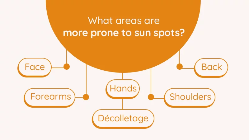 What areas are more prone to sun spots