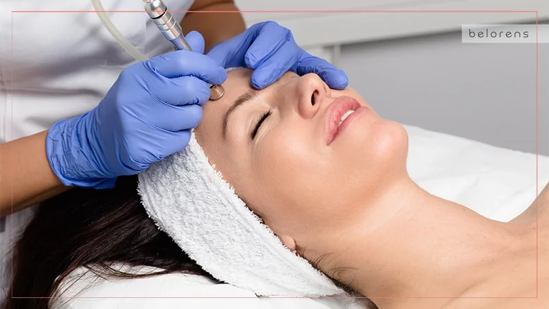 Microdermabrasion