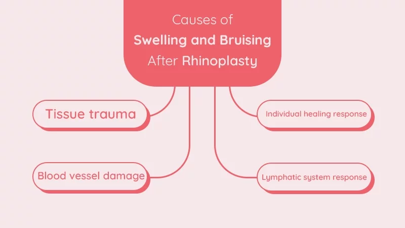 Info-Causes of Swelling and Bruising After Rhinoplasty