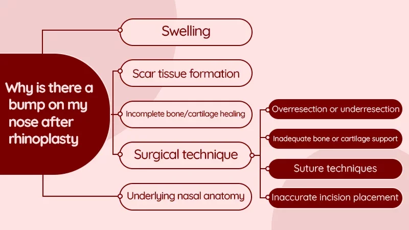 Why is there a bump on my nose after rhinoplasty