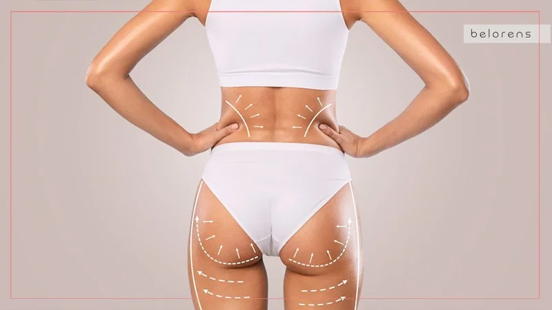 Brazilian butt lift (BBL)