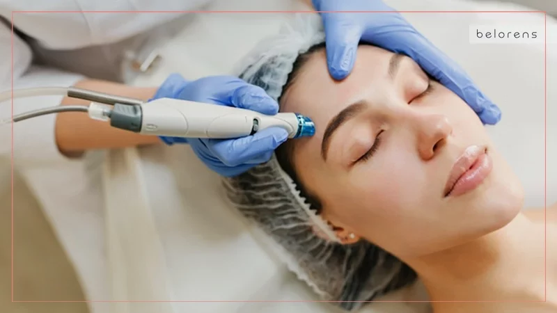 Microdermabrasion