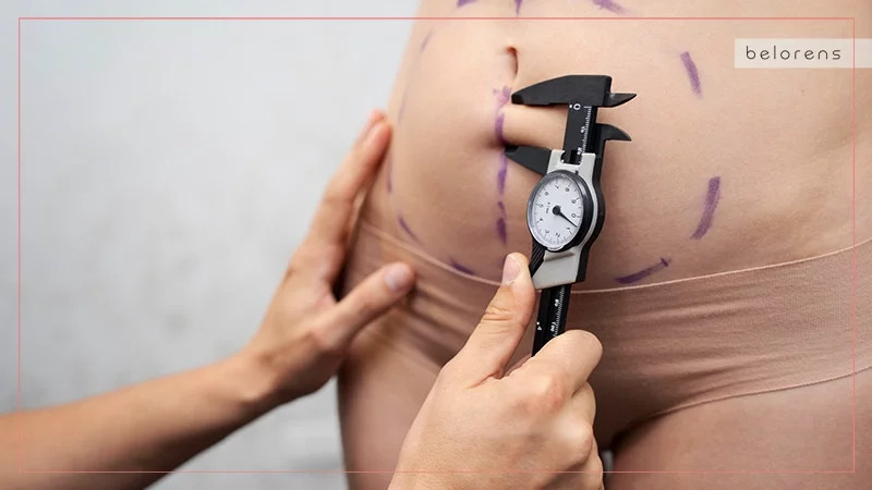 Other alternatives to Lipo 360
