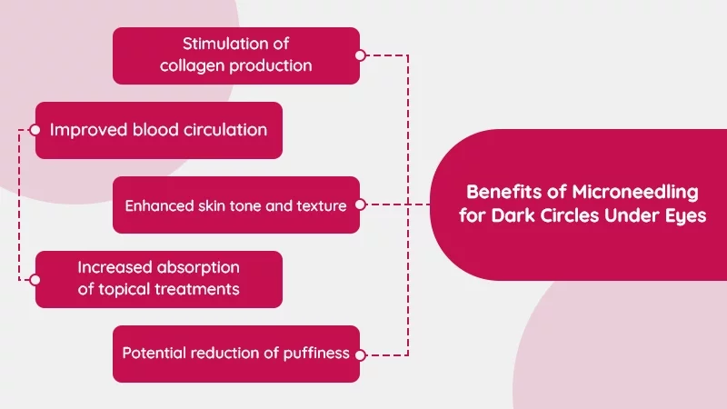 Benefits of Microneedling for Dark Circles Under Eyes