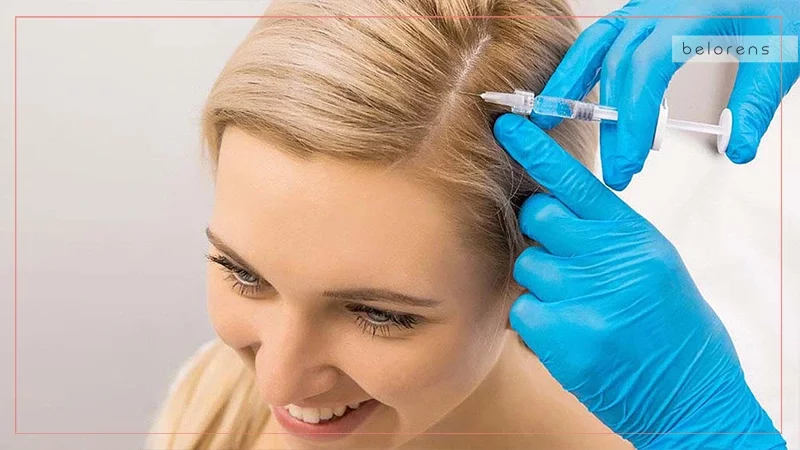 How are steroid injections for hair loss performed