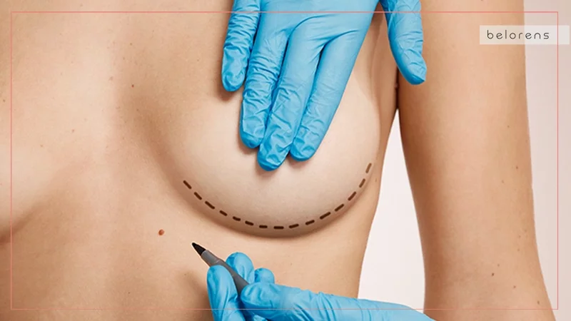 Is it common to combine a breast lift with a breast augmentation