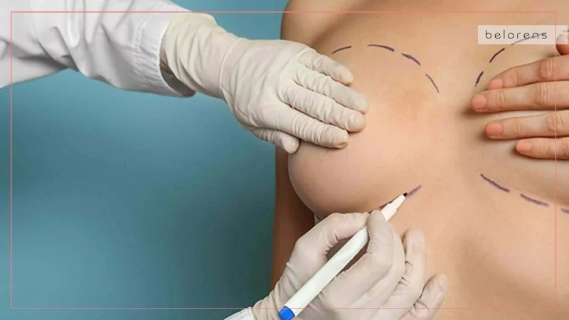 What implant size and shape should I choose for more convenience during physical activities