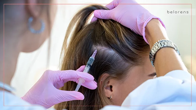 What types of hair loss can't steroid injections address