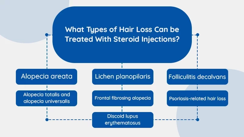 What Types of Hair Loss Can be Treated With Steroid
