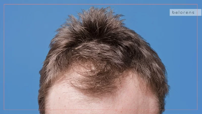 التدخلات الحديثة والتكنولوجيا