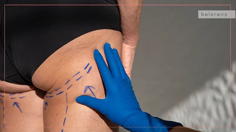 الضغوط المجتمعية والمعايير الجمالية