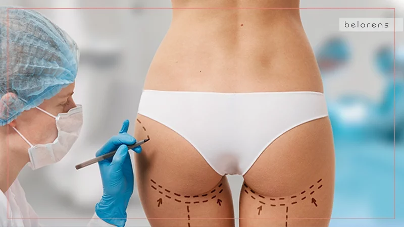 المنافسة في السوق