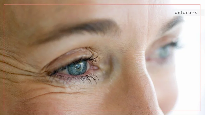 Drooping eyelids