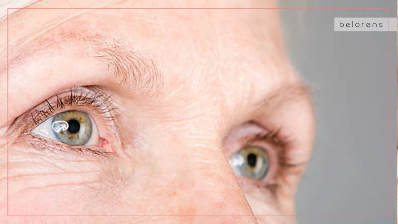 Loss of elasticity and firmness around the eyes