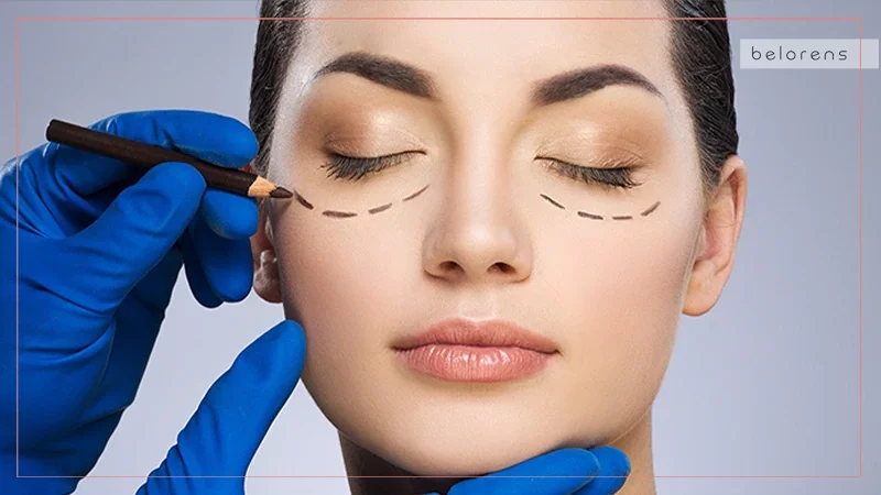 Lower blepharoplasty