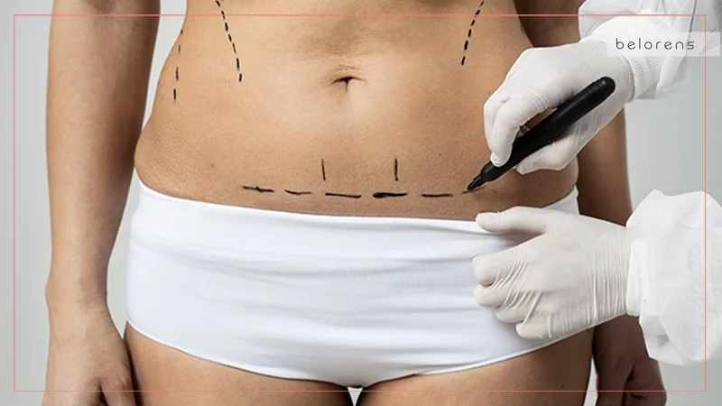Stay Hydrated in your Liposuction Diet