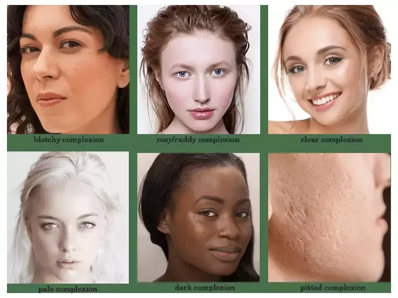 What is skin complexion
