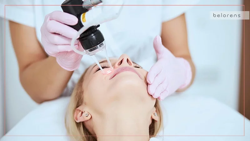 How fractional laser treatment is performed