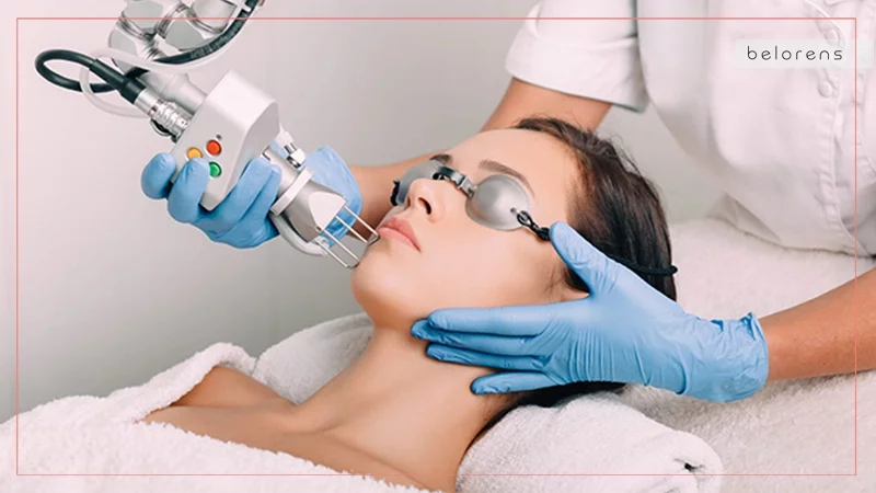 How fractional lasers work