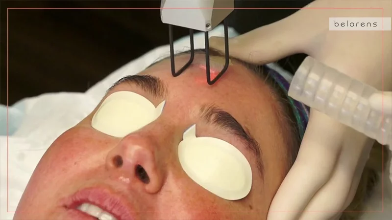 Is CO2 laser treatment safe