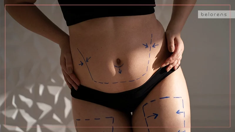 Myth 9 Liposuction is extremely painful