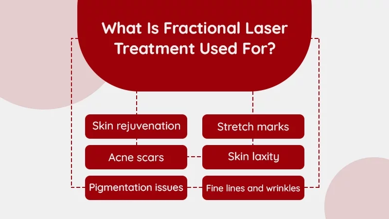 What Is Fractional Laser Treatment Used For