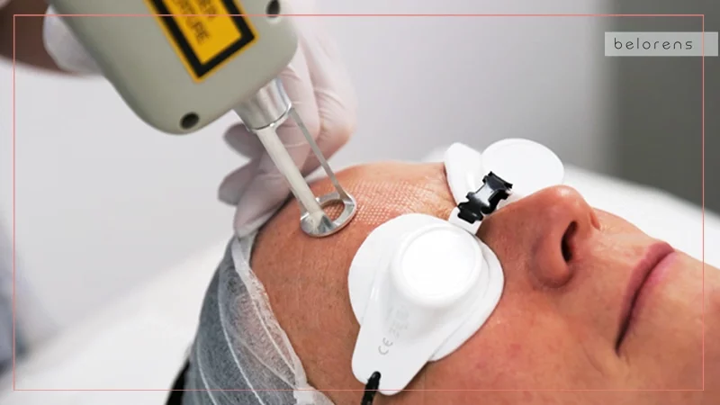 What to expect after the procedure